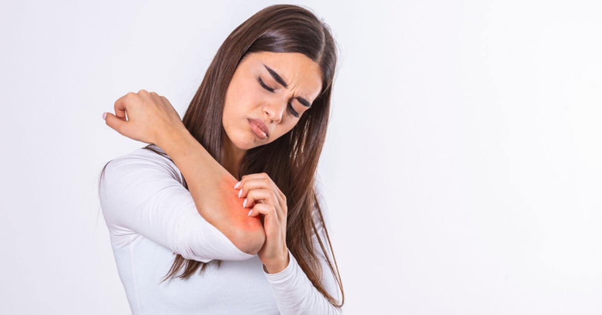 Aufbruch in ein neues Zeitalter! Oruka Therapeutics revolutioniert die Zukunft der Psoriasis-Behandlung!