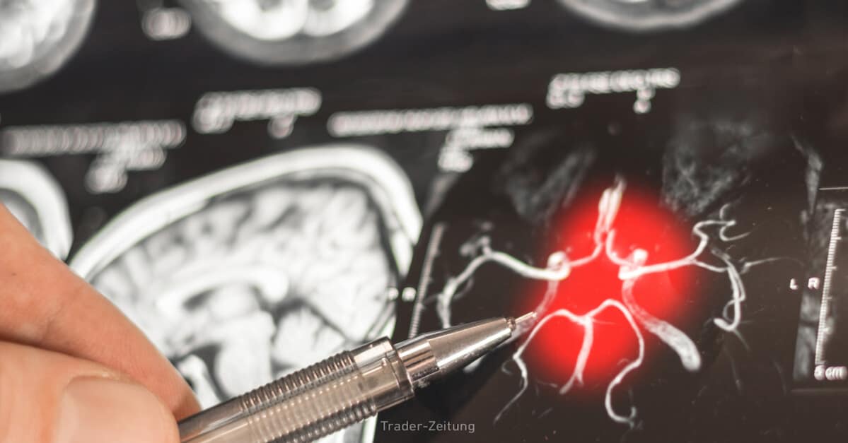 Enliven Therapeutics meldet klinischen Durchbruch bei therapieresistenter Leukämie