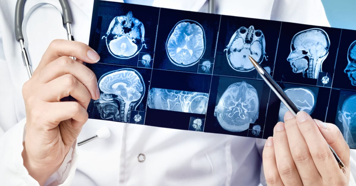 ClearPoint Neuro: Gentherapiepartner und neue Robotertechnik sorgen für Kursexplosion