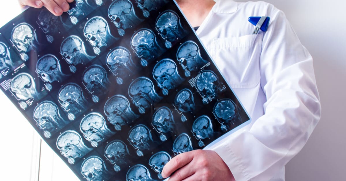 Pivotal-Point Nachverfolgung Supernus Pharmaceuticals (SUPN): Kursziel-Explosion nach Piper Sandler-Upgrade – Parkinson-Medikament Onapgo als neuer Umsatz-Star! Pivotal-Point Nachverfolgung Supernus Pharmaceuticals (SUPN): Kursziel-Explosion nach Piper Sandler-Upgrade – Parkinson-Medikament Onapgo als neuer Umsatz-Star!