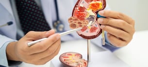 Aktien on Fire: DaVita: Komplettanbieter für die Nierengesundheit überrascht mit Gewinnprognose von 33 % - KGV sinkt auf etwa 8!