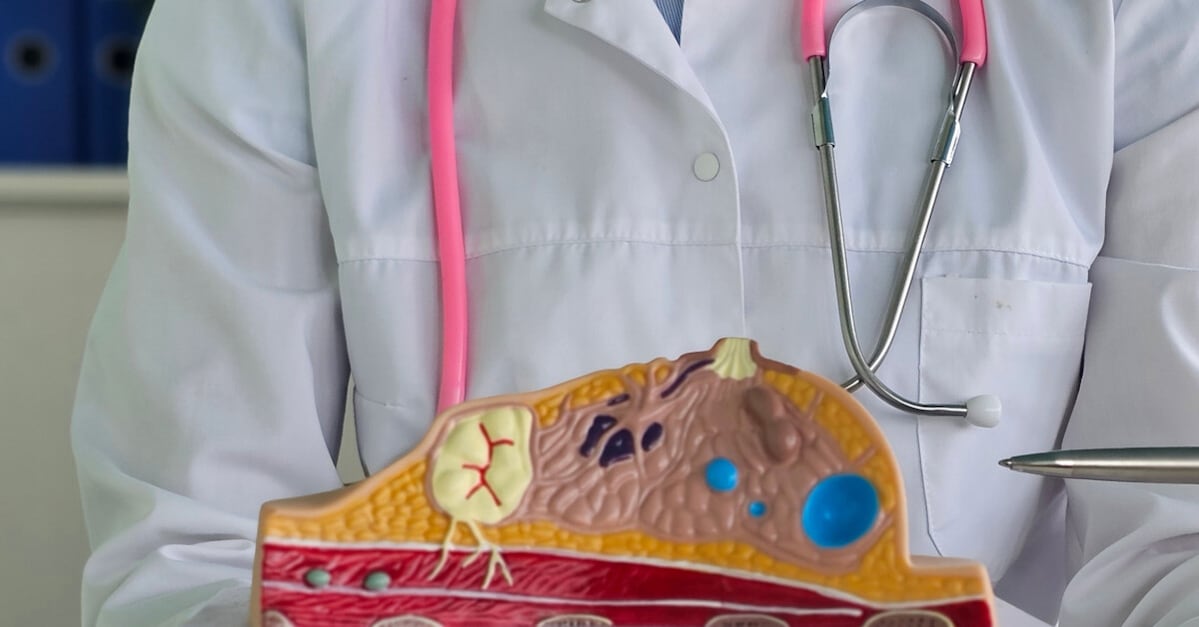 Relay Therapeutics überzeugt mit belastbaren Zwischendaten bei mutiertem Brustkrebs