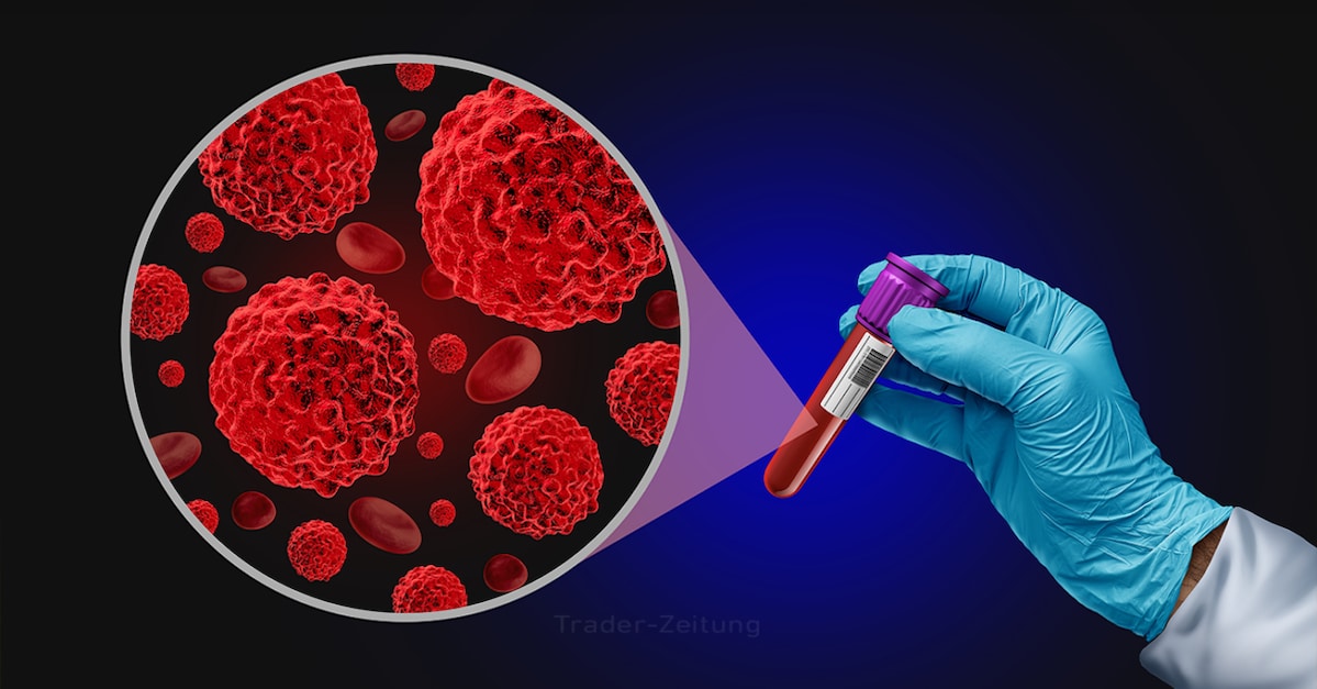 Guardant Health - Anziehende Patientenzahlen bescheren Diagnostik-Spezialisten starke Aussichten