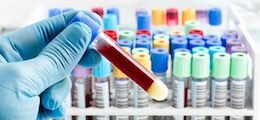 : Государственным больницам расширят запрет на импортную медтехнику